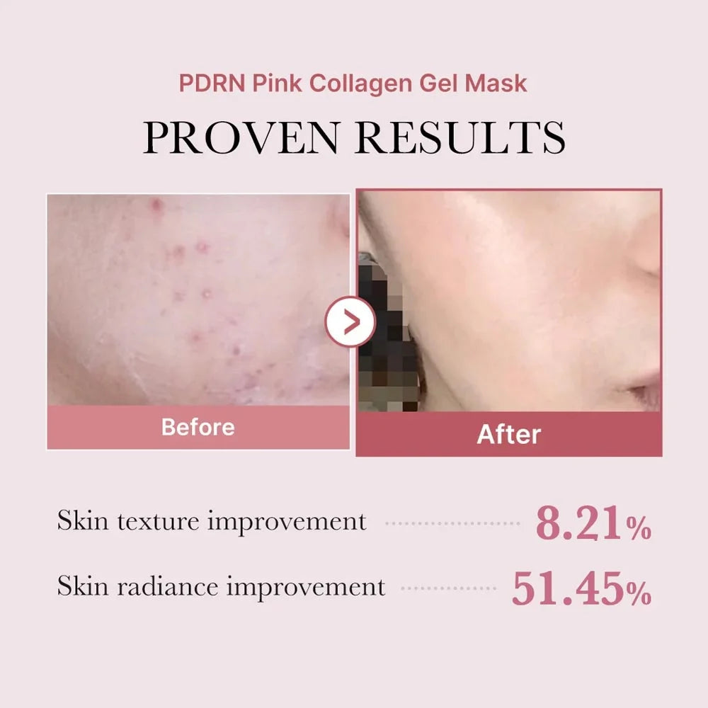 Medicube - PDRN Pink Collagen Gel Mask, productfoto 2